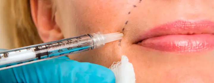 Dermal Fillers